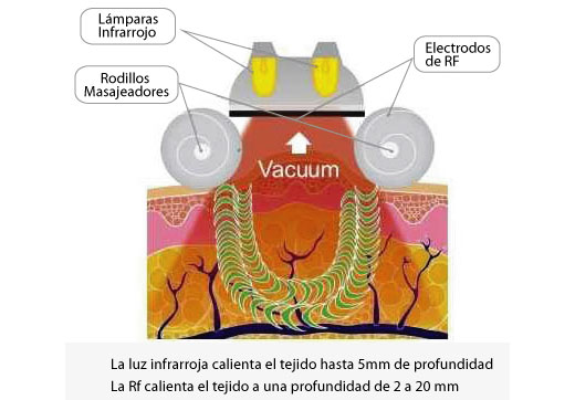 Velaslim